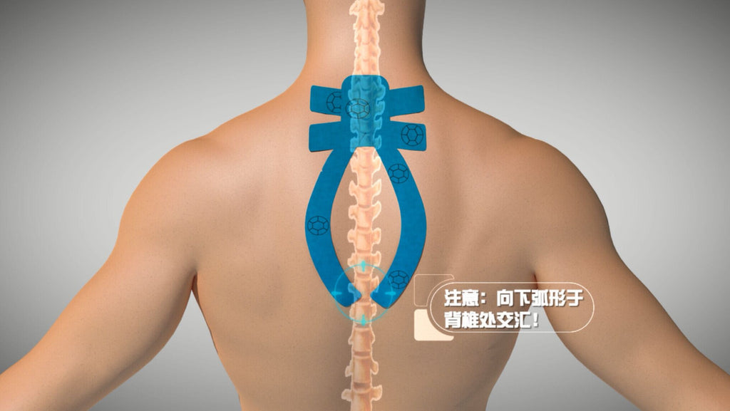 Neck Pain, physiotherapy solution