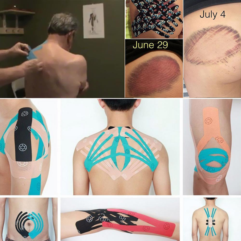 What is Kintape or Kinesiology tape used for?