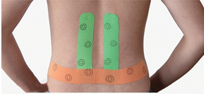 Kintape for lower back pain (Taping for Waist)